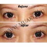 wm_double_eyelid_tape_before_afterbn.jpg